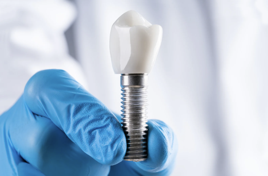 The Evolution of Dental Implant Instruments: From Traditional to Digital Guides