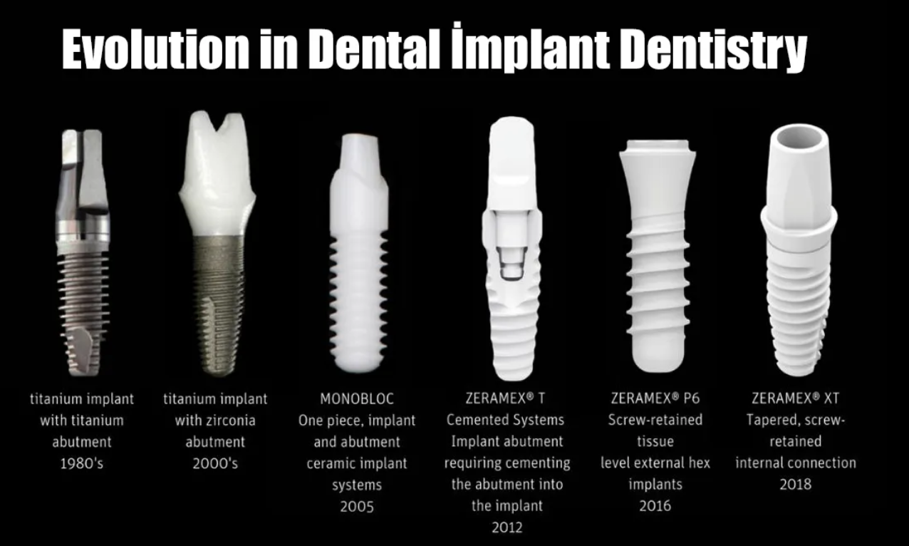 The Evolution of Dental Implant Instruments: From Traditional to Digital Guides