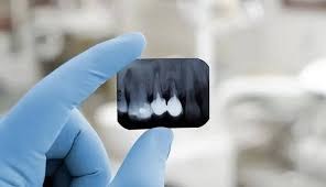 Equipment and materials needed to open a dental clinic