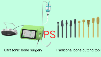 Cost benefit comparison between dental ultrasonic bone surgery and traditional bone cutting tools