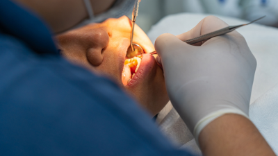 How to choose ultrasound bone surgery