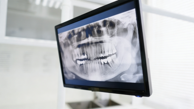 Top 10 Trends in the Global Dental Equipment Market for 2025