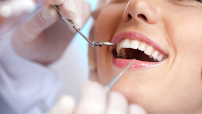 Is dental curing light UV light bad for patient?