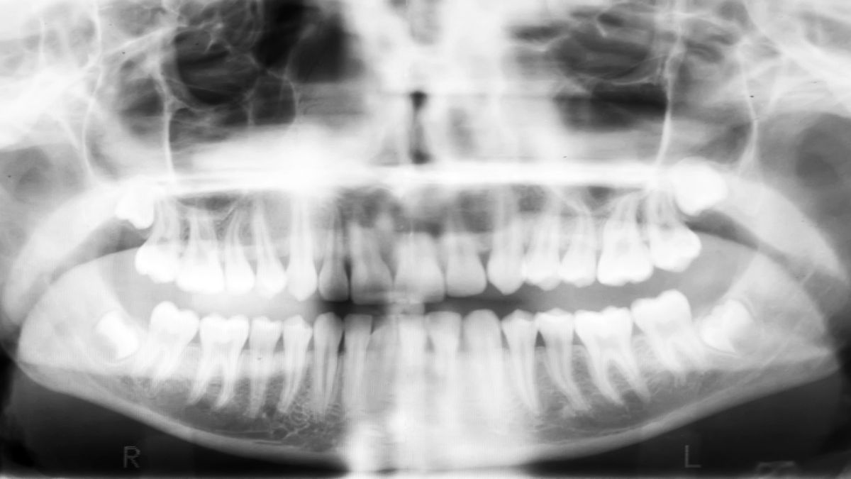 Dental Digital Imaging Equipment Trends