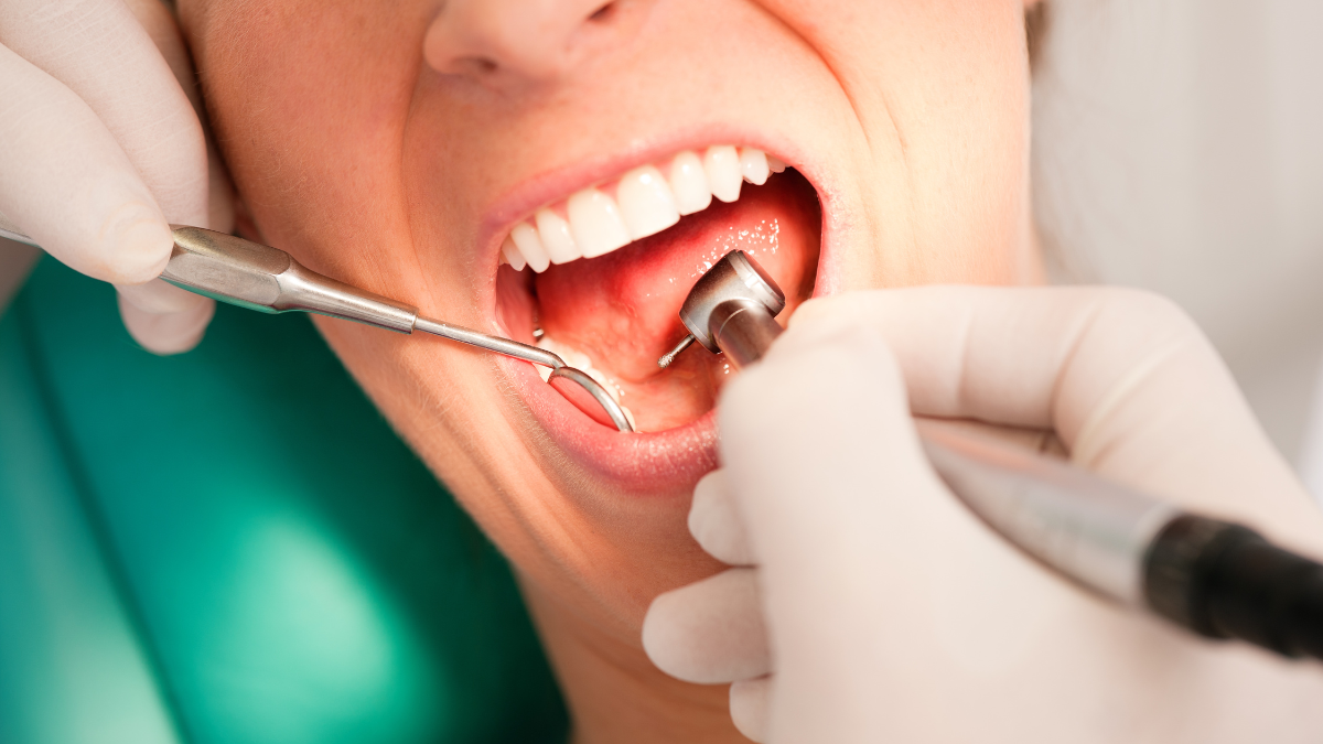 Is cleaning teeth good or bad? Is cleaning teeth good or bad?