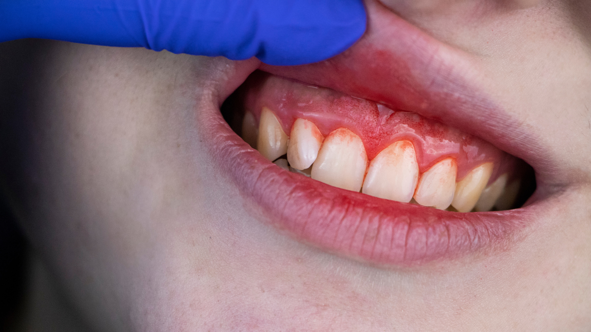 Why do teeth ache when eating?