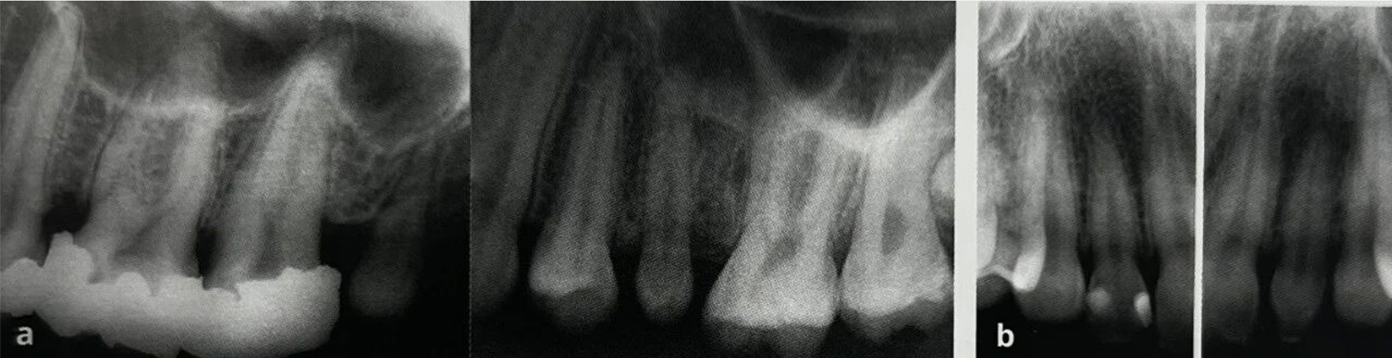 Common Dental Anomalies in Oral Imaging