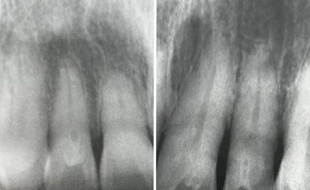 Common Dental Anomalies in Oral Imaging