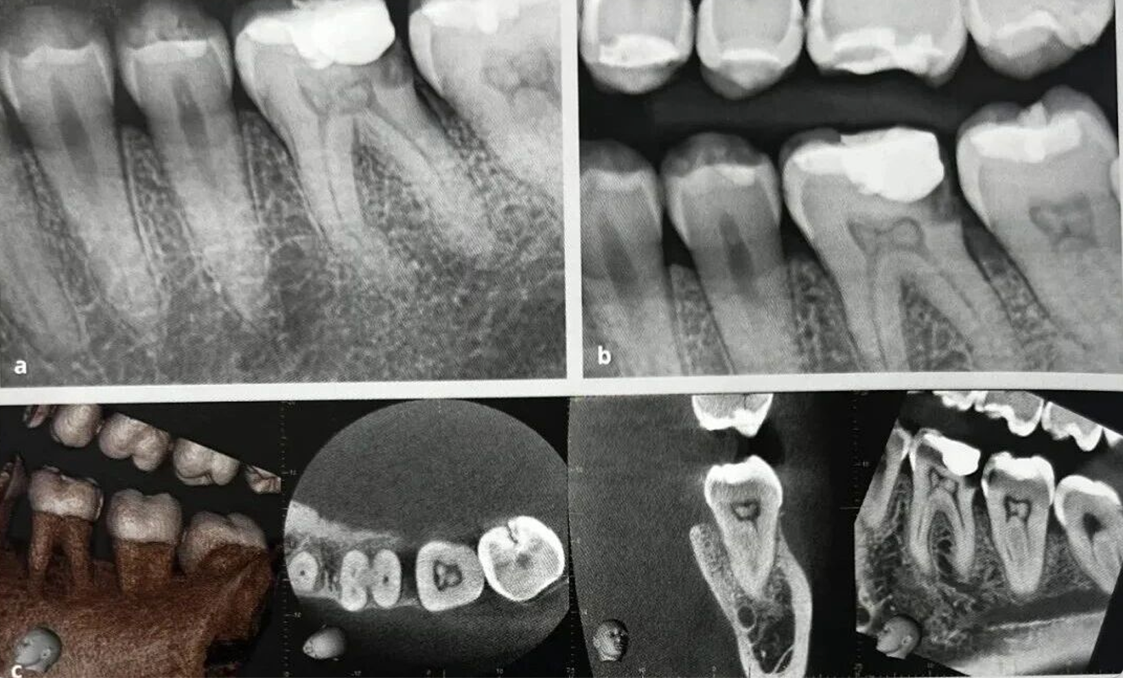 Common Dental Anomalies in Oral Imaging