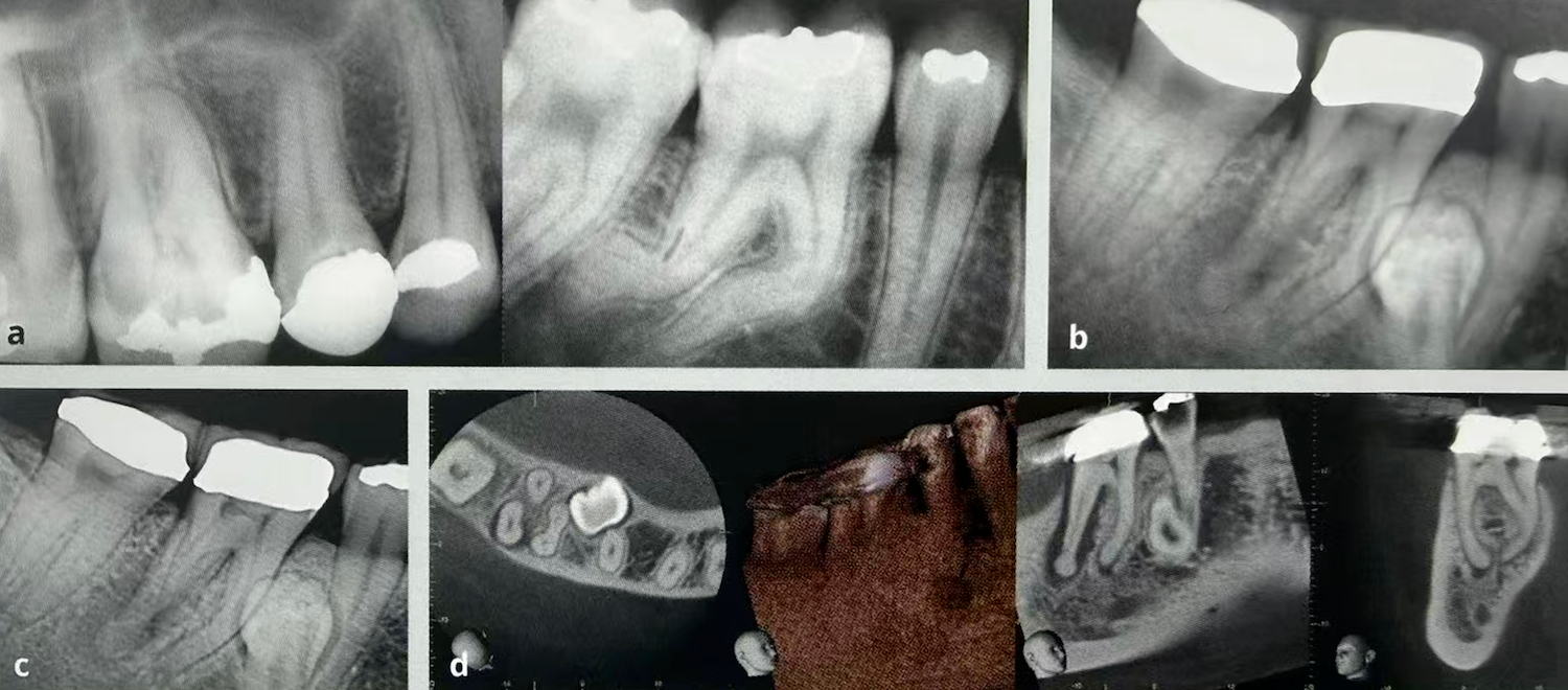 Common Dental Anomalies in Oral Imaging