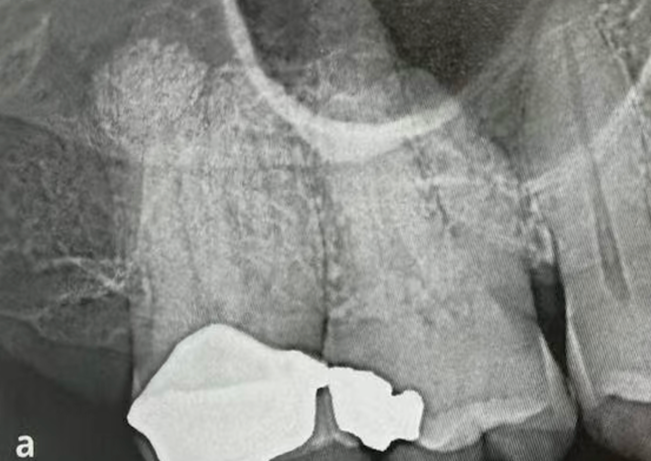 Common Dental Anomalies in Oral Imaging