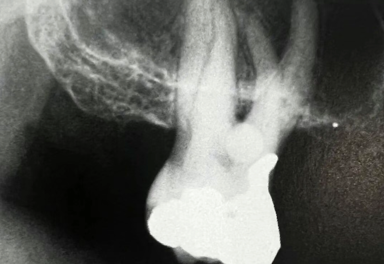 Common Dental Anomalies in Oral Imaging