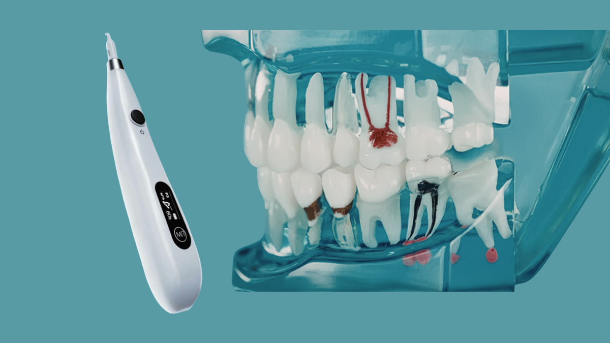 What is endo activator？