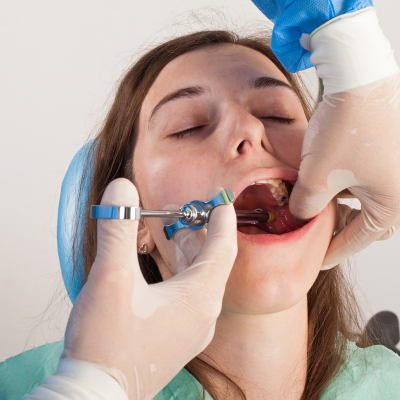 What is the side effect of dental electric anesthesia? What is the side effect of dental electric anesthesia?