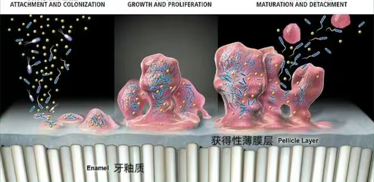How did perfectly good teeth decay?