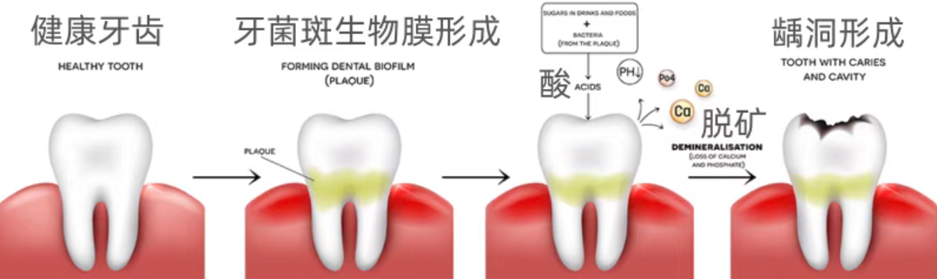 How did perfectly good teeth decay?