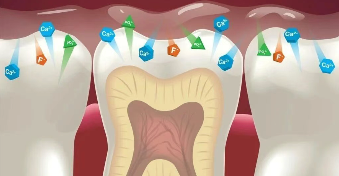 How did perfectly good teeth decay?