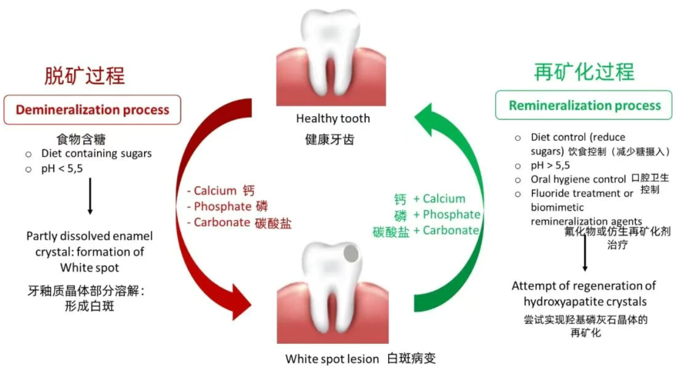 How did perfectly good teeth decay?