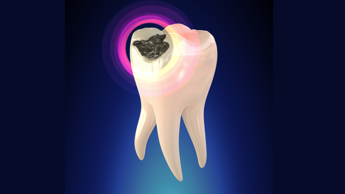 Why do good teeth become decayed？