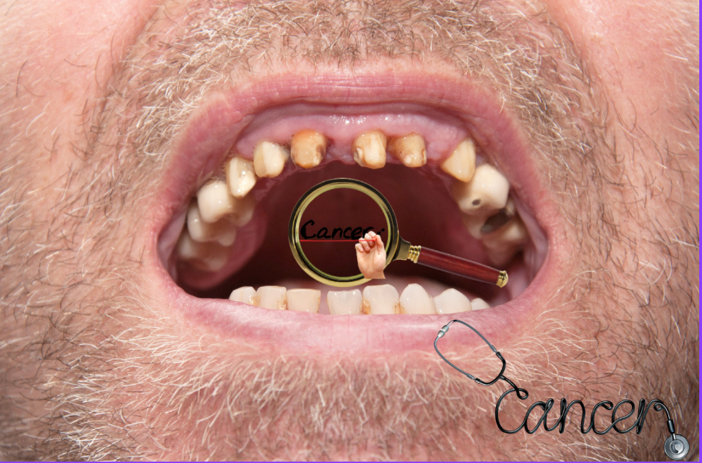 Do you know that poor dental hygiene can lead to many diseases?