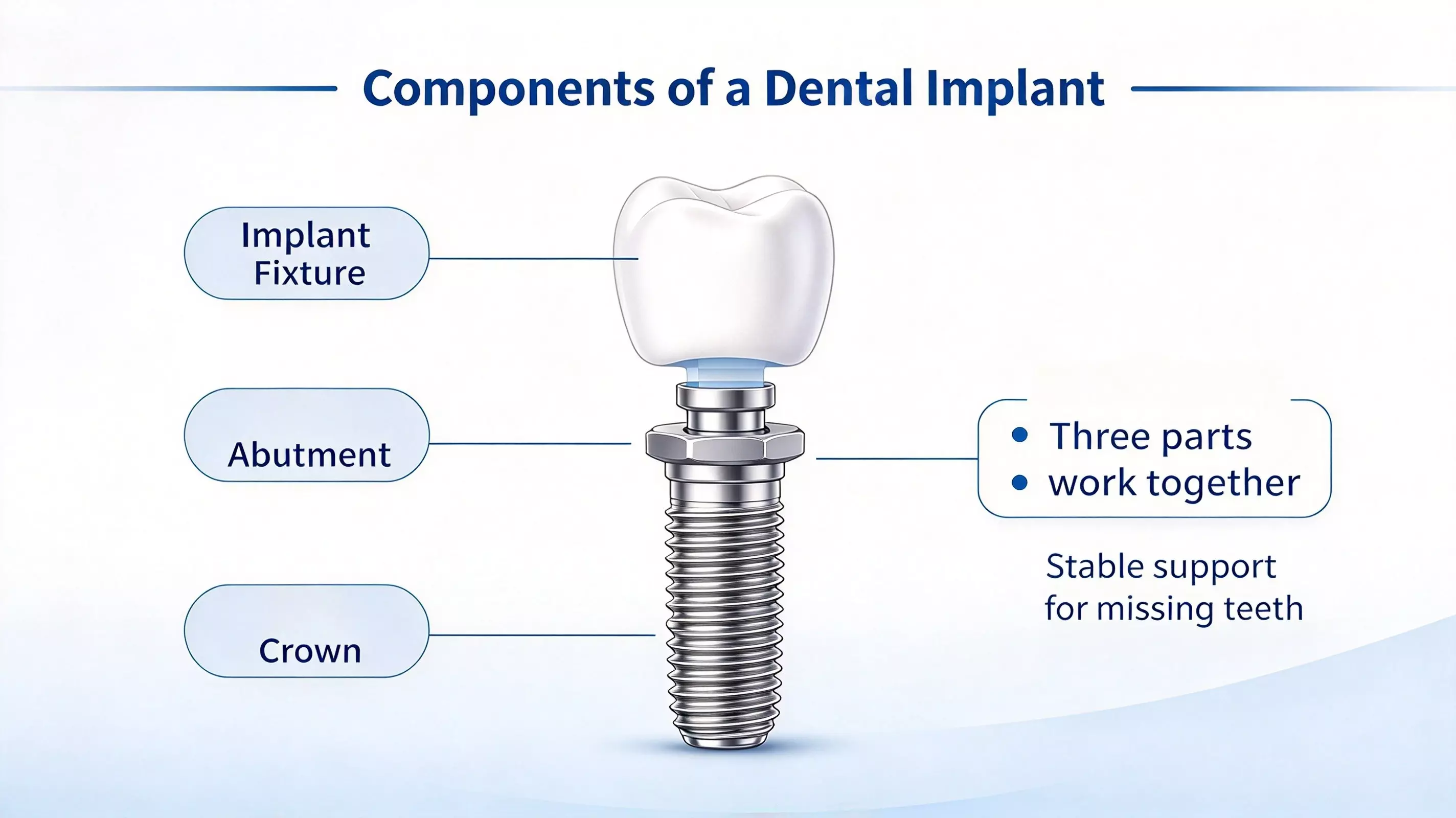 What are dental implants? What are dental implants?